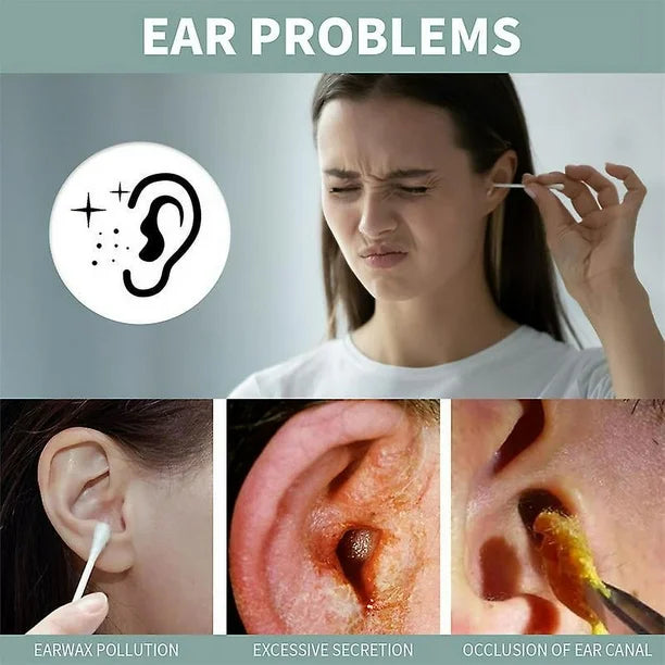Anti Tinnitus - Sprej za uklanjanje ušnog voska 1+1 GRATIS