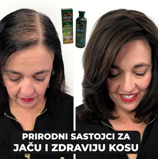 Šampon sa ekstraktom belog luka - Protiv opadanja i za brži rast kose