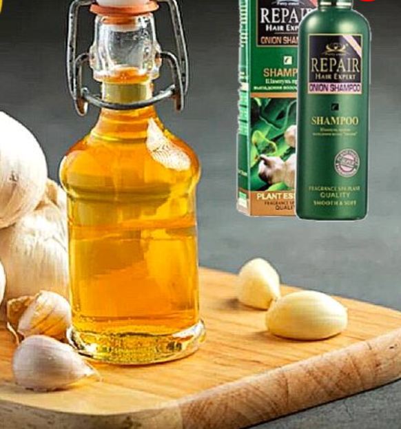 Šampon sa ekstraktom belog luka - Protiv opadanja i za brži rast kose